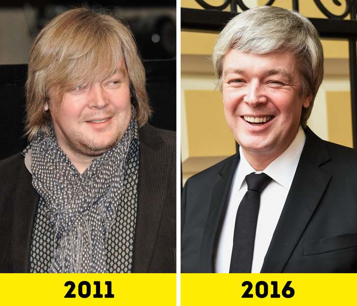 20 російських зірок, які попрацювали над зовнішністю і стали виглядати молодше