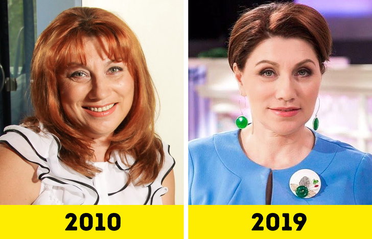 20 російських зірок, які попрацювали над зовнішністю і стали виглядати молодше