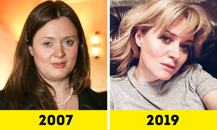 20 російських зірок, які попрацювали над зовнішністю і стали виглядати молодше