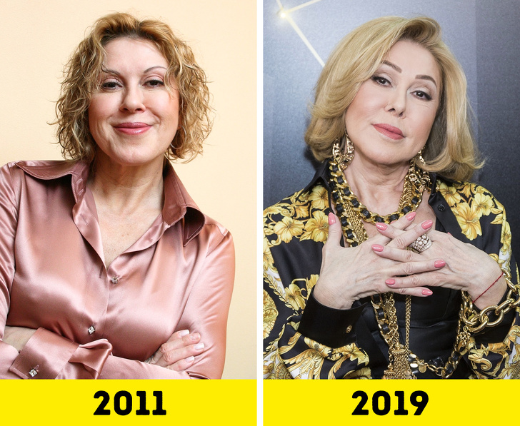 20 російських зірок, які попрацювали над зовнішністю і стали виглядати молодше