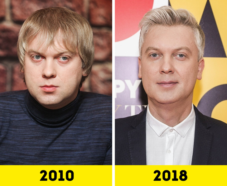 20 російських зірок, які попрацювали над зовнішністю і стали виглядати молодше