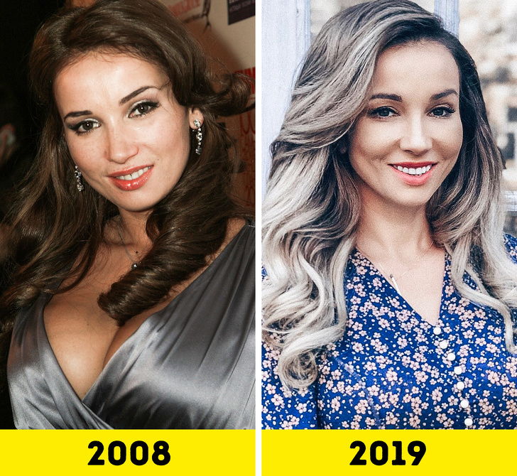 20 російських зірок, які попрацювали над зовнішністю і стали виглядати молодше