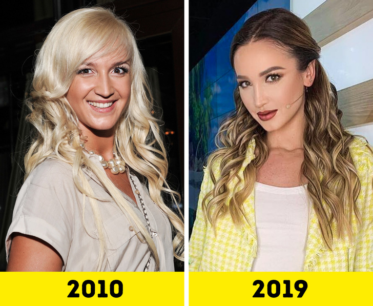 20 російських зірок, які попрацювали над зовнішністю і стали виглядати молодше
