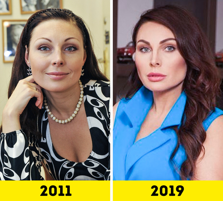 20 російських зірок, які попрацювали над зовнішністю і стали виглядати молодше