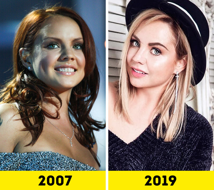 20 російських зірок, які попрацювали над зовнішністю і стали виглядати молодше