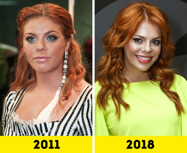 20 російських зірок, які попрацювали над зовнішністю і стали виглядати молодше