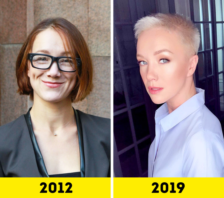 20 російських зірок, які попрацювали над зовнішністю і стали виглядати молодше