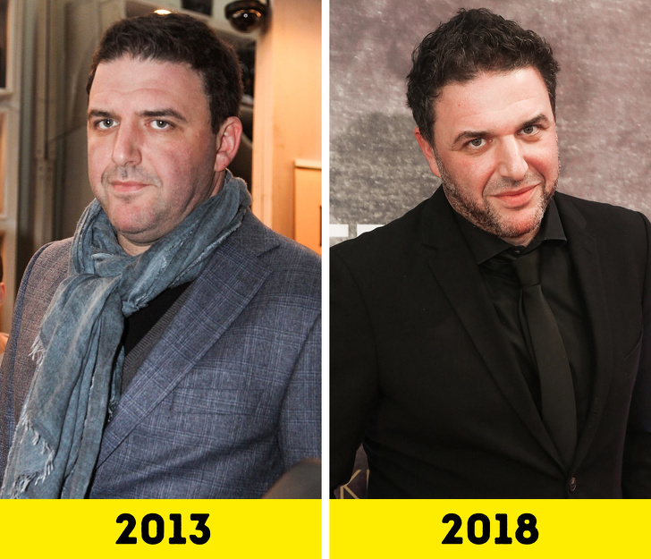 20 російських зірок, які попрацювали над зовнішністю і стали виглядати молодше