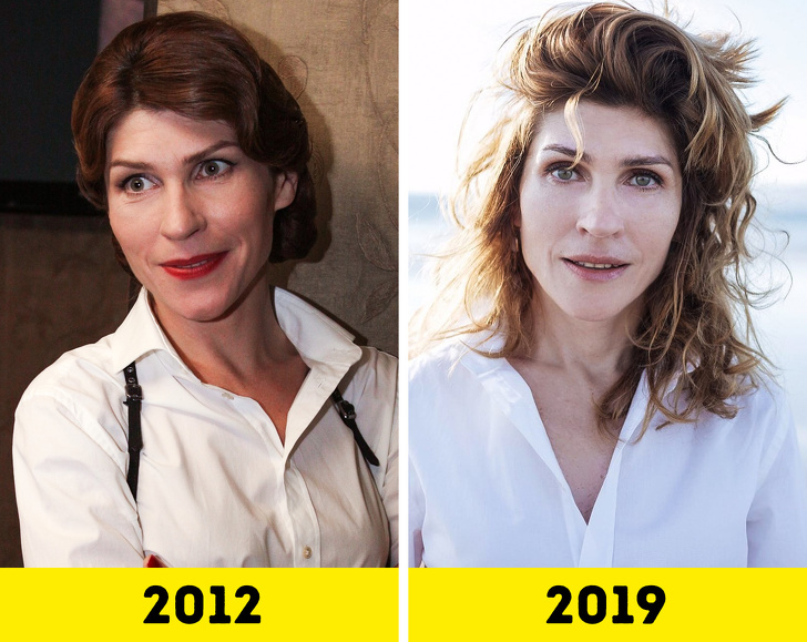 20 російських зірок, які попрацювали над зовнішністю і стали виглядати молодше