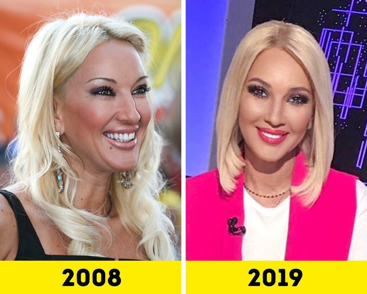 20 російських зірок, які попрацювали над зовнішністю і стали виглядати молодше