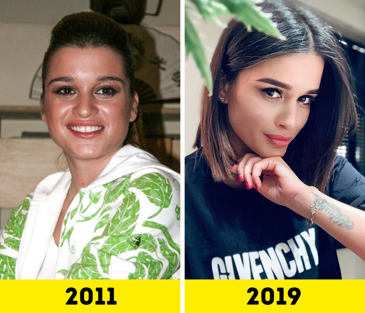 20 російських зірок, які попрацювали над зовнішністю і стали виглядати молодше