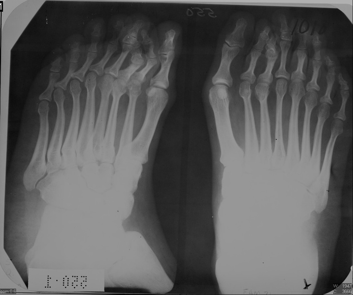 20 знімків, які раніше бачили тільки рентгенологи. А тепер можете і ви