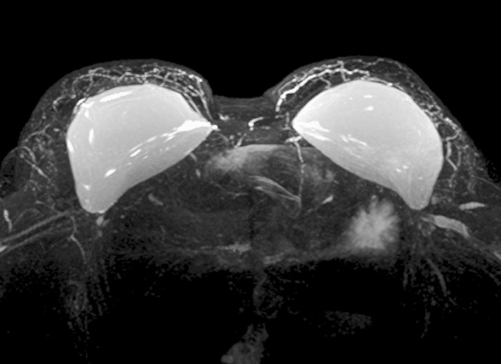 20 знімків, які раніше бачили тільки рентгенологи. А тепер можете і ви