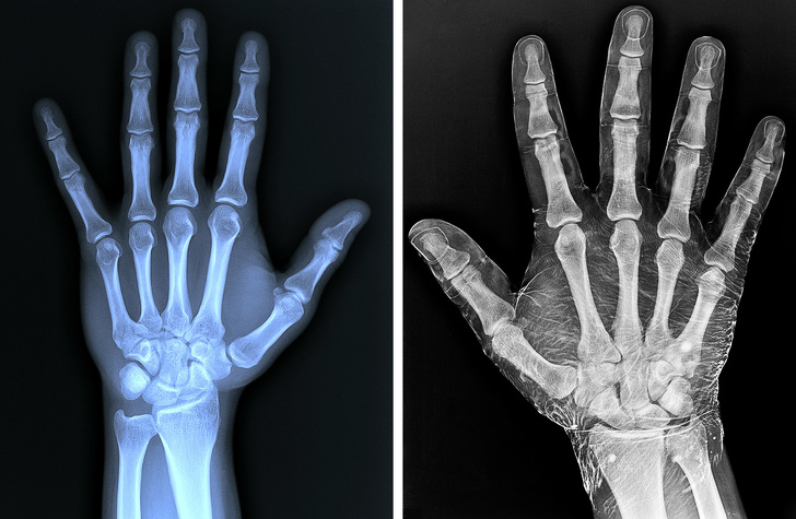 20 знімків, які раніше бачили тільки рентгенологи. А тепер можете і ви
