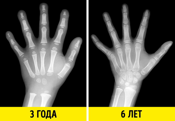 20 знімків, які раніше бачили тільки рентгенологи. А тепер можете і ви