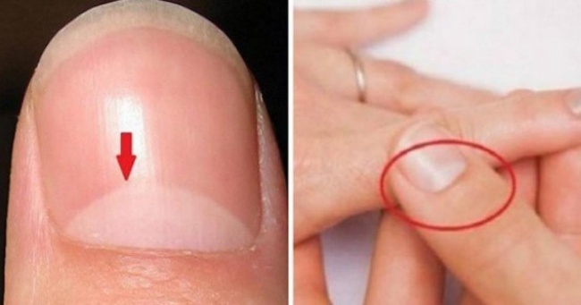 21 вражаючий факт про нашому тілі, які ми не знали