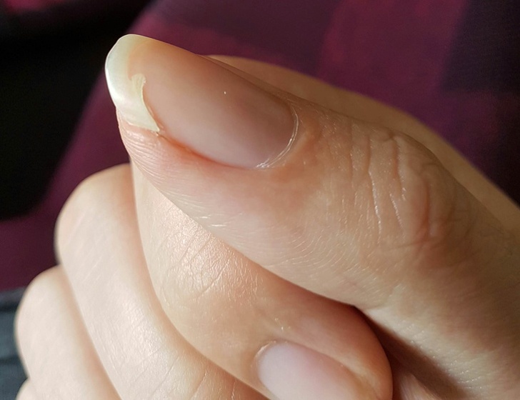 25+ дрібниць, які виводять з себе мільйони людей по всьому світу