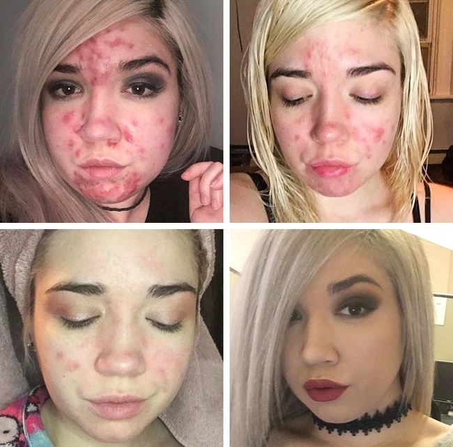 25 осіб, які встигли прокинутися, поки не стало занадто пізно