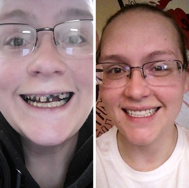 25 осіб, які встигли прокинутися, поки не стало занадто пізно