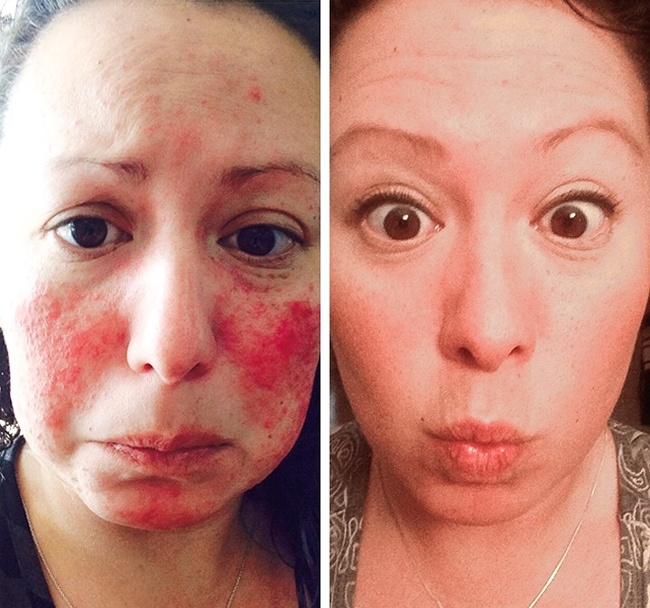 25 осіб, які встигли прокинутися, поки не стало занадто пізно