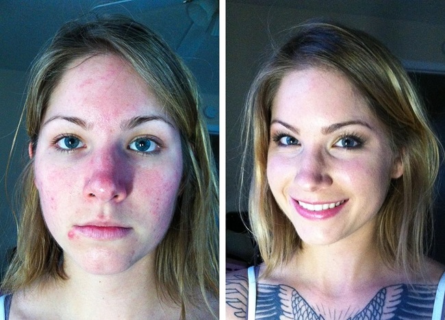 25 осіб, які встигли прокинутися, поки не стало занадто пізно