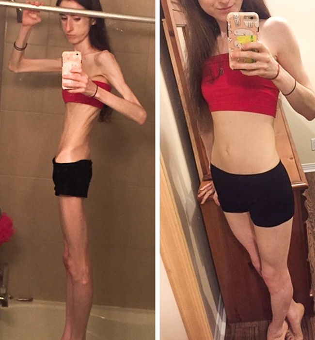 25 осіб, які встигли прокинутися, поки не стало занадто пізно