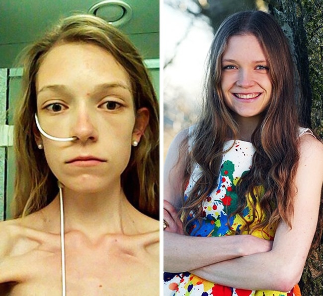 29 осіб, які досягли у своєму житті кнопку перезавантаження