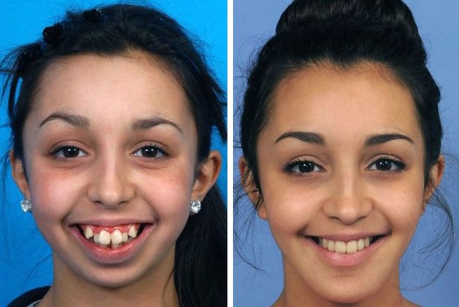 29 осіб, які досягли у своєму житті кнопку перезавантаження