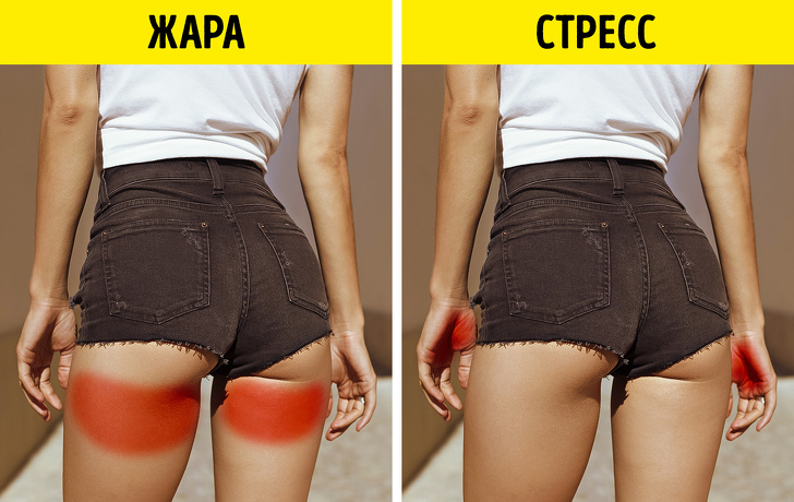 8 проблем, які ховаються за неприємним запахом тіла