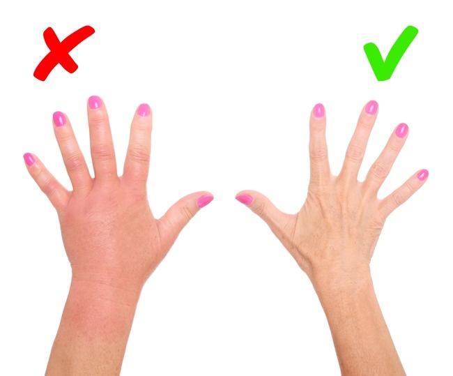 8 серйозних захворювань, про яких сигналізує наша шкіра