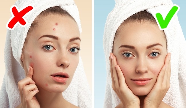 8 серйозних захворювань, про яких сигналізує наша шкіра