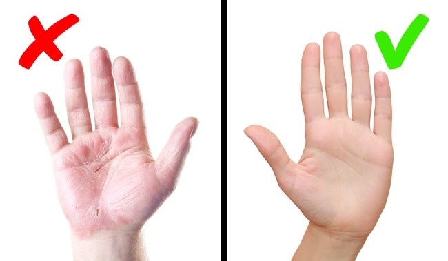 8 серйозних захворювань, про яких сигналізує наша шкіра