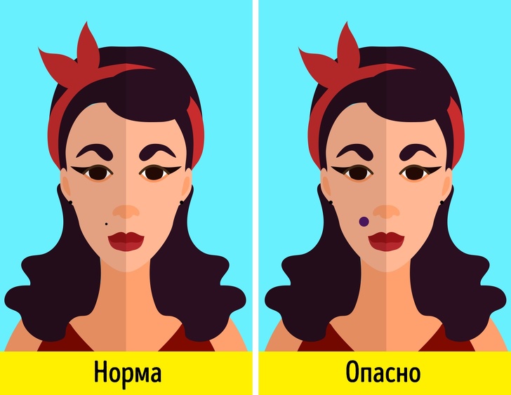 8 симптомів, що жінкам не можна закривати очі