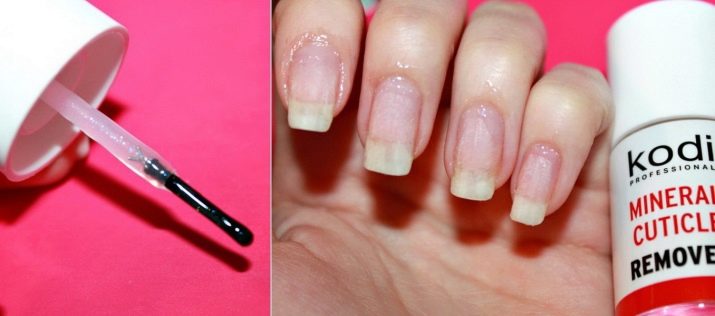 Ремувер для кутикули: як користуватися і чим можна замінити? Як за допомогою ремувера видалити кутикулу? Відгуки