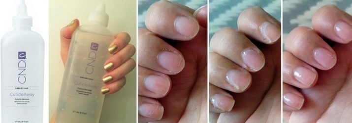Ремувер для кутикули: як користуватися і чим можна замінити? Як за допомогою ремувера видалити кутикулу? Відгуки