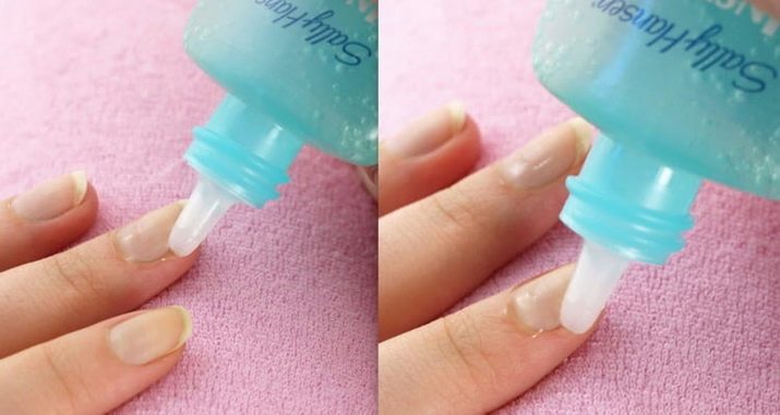 Ремувер для кутикули: як користуватися і чим можна замінити? Як за допомогою ремувера видалити кутикулу? Відгуки