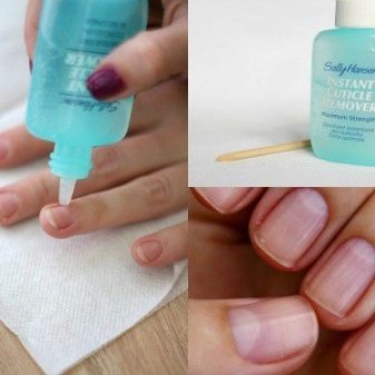 Ремувер для кутикули: як користуватися і чим можна замінити? Як за допомогою ремувера видалити кутикулу? Відгуки