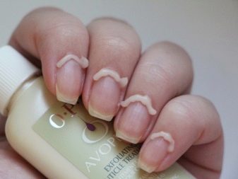 Ремувер для кутикули: як користуватися і чим можна замінити? Як за допомогою ремувера видалити кутикулу? Відгуки