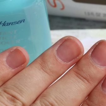 Ремувер для кутикули: як користуватися і чим можна замінити? Як за допомогою ремувера видалити кутикулу? Відгуки