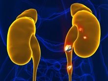 Рожевий перли: скільки коштує і з чим носити? Особливості каменю і його магічні властивості