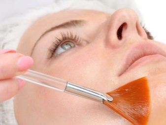 Саліциловий пілінг (29 фото): рецепт з кислотою для хімічної процедури від прищів, як робити в домашніх умовах, відгуки