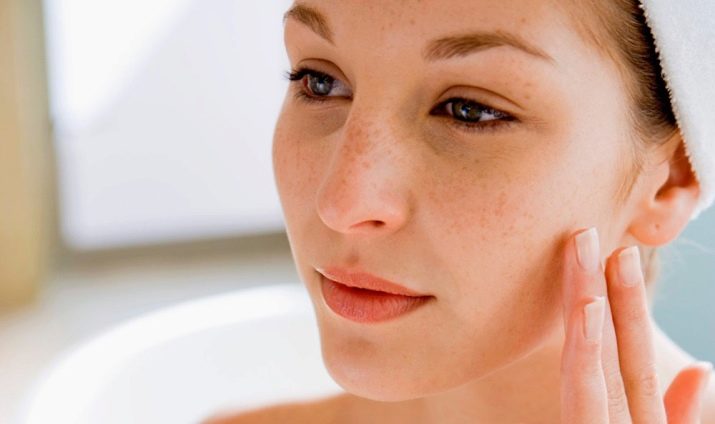 Саліциловий пілінг (29 фото): рецепт з кислотою для хімічної процедури від прищів, як робити в домашніх умовах, відгуки