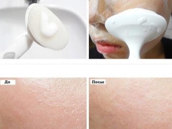 Щіточки для вмивання: силіконові, електричні та щітки-масажери для особи. Моделі від Foreo та інші. Як користуватися?