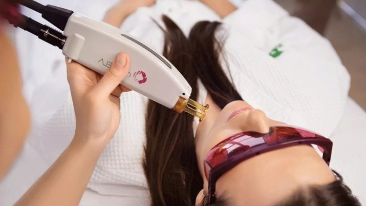 Що робити, якщо в дівчини ростуть вуса? Як назавжди прибрати їх в домашніх умовах? Як швидко видалити або знебарвити вуса у жінок?