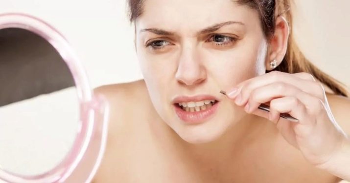 Що робити, якщо в дівчини ростуть вуса? Як назавжди прибрати їх в домашніх умовах? Як швидко видалити або знебарвити вуса у жінок?