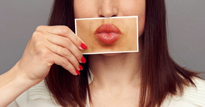 Що робити, якщо в дівчини ростуть вуса? Як назавжди прибрати їх в домашніх умовах? Як швидко видалити або знебарвити вуса у жінок?