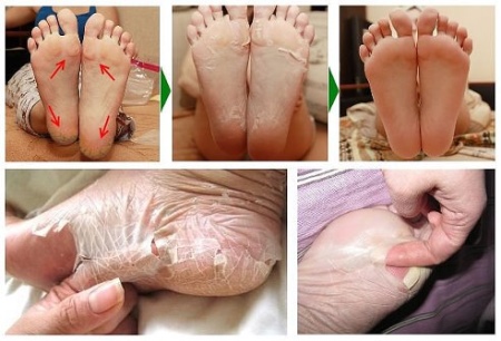 Шкарпетки SOSU (55 фото): японські шкарпетки для педикюру, інструкція та відгуки