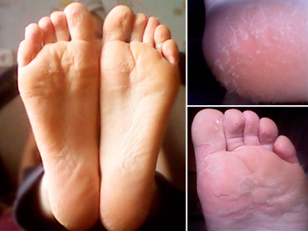 Шкарпетки SOSU (55 фото): японські шкарпетки для педикюру, інструкція та відгуки