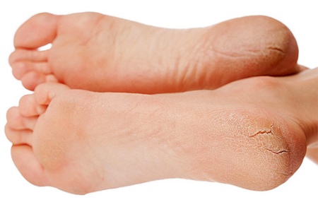 Шкарпетки SOSU (55 фото): японські шкарпетки для педикюру, інструкція та відгуки