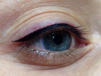 Татуаж вій (27 фото): як робиться? Догляд після перманентного макіяжу. Коли можна фарбувати очі після татуажу століття? Особливості биотатуажа